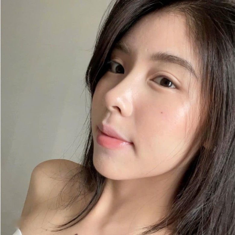 Loại sụn thường dùng để giảm biến chứng?