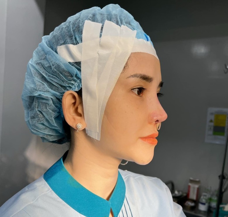 Nguyên tắc chọn bác sĩ nâng mũi?