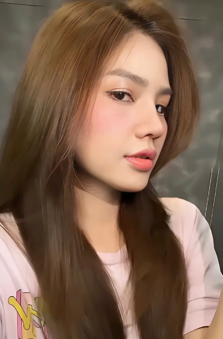 Kỹ thuật nâng mũi nào giúp chỉnh hình toàn bộ dáng mũi, kể cả đầu mũi?