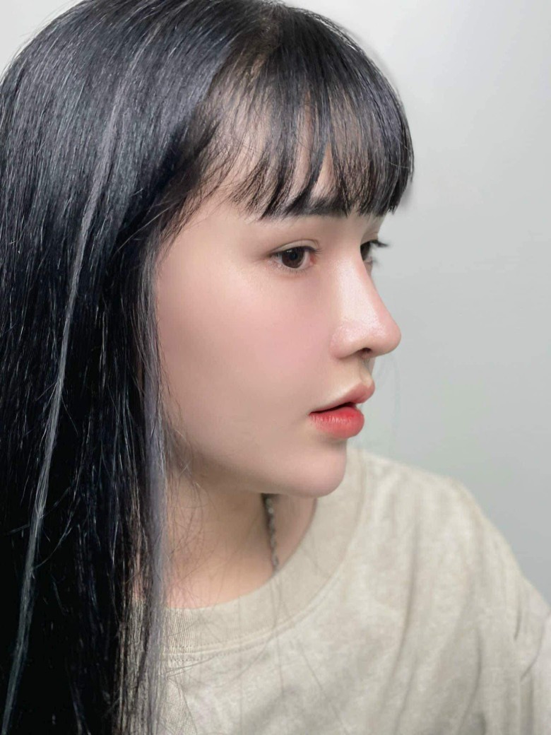 Những ai nên nâng mũi cấu trúc?