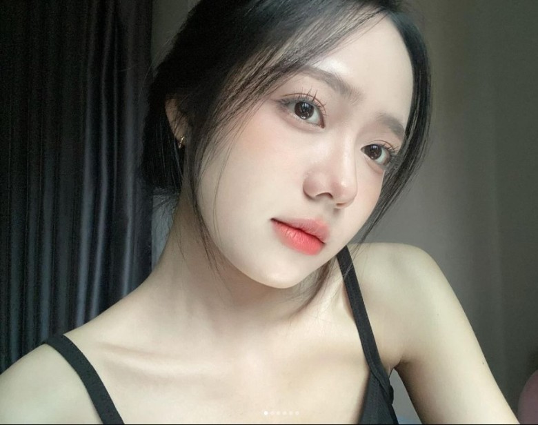 Nguyên nhân khiến mũi đỏ bóng sau nâng bọc sụn?