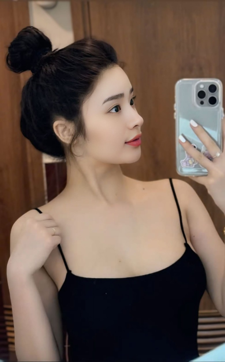 Vì sao nên khám sức khỏe trước nâng mũi?