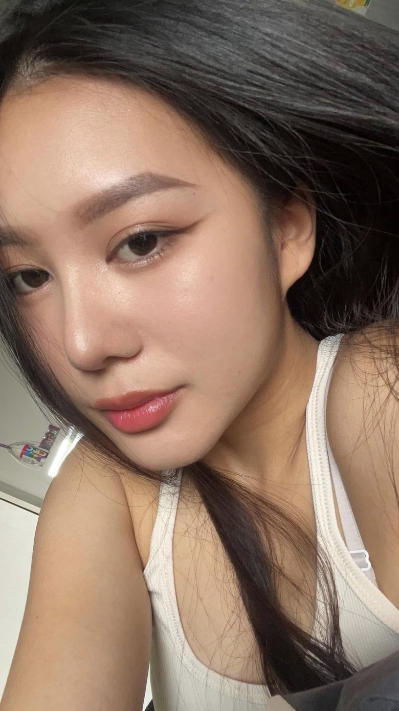 Khi nào nên chọn nâng mũi cấu trúc?