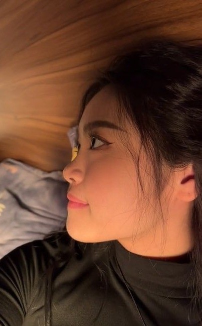 Khi nào nên dùng sụn sườn để nâng mũi?