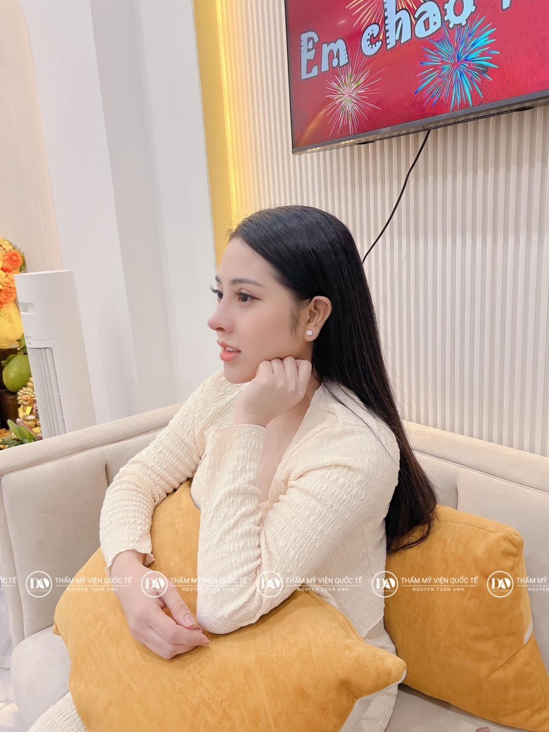 Kỹ thuật nâng mũi nào phù hợp với mặt tròn muốn sống mũi thon gọn?