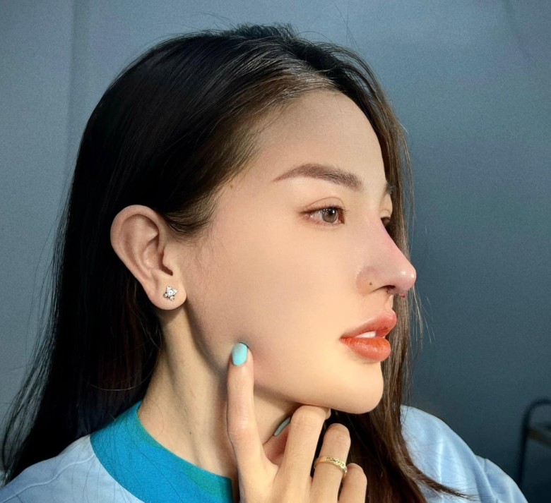 Cách vệ sinh mũi sau nâng đúng?