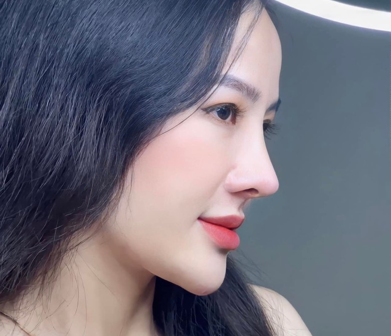 Uống thuốc sau nâng mũi cần lưu ý gì?