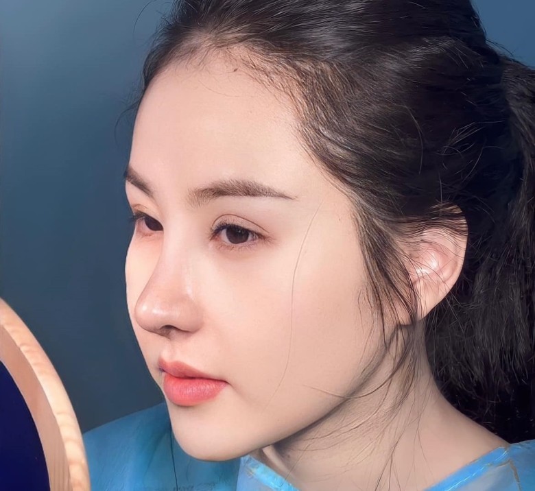 Dấu hiệu hoại tử mũi là gì?