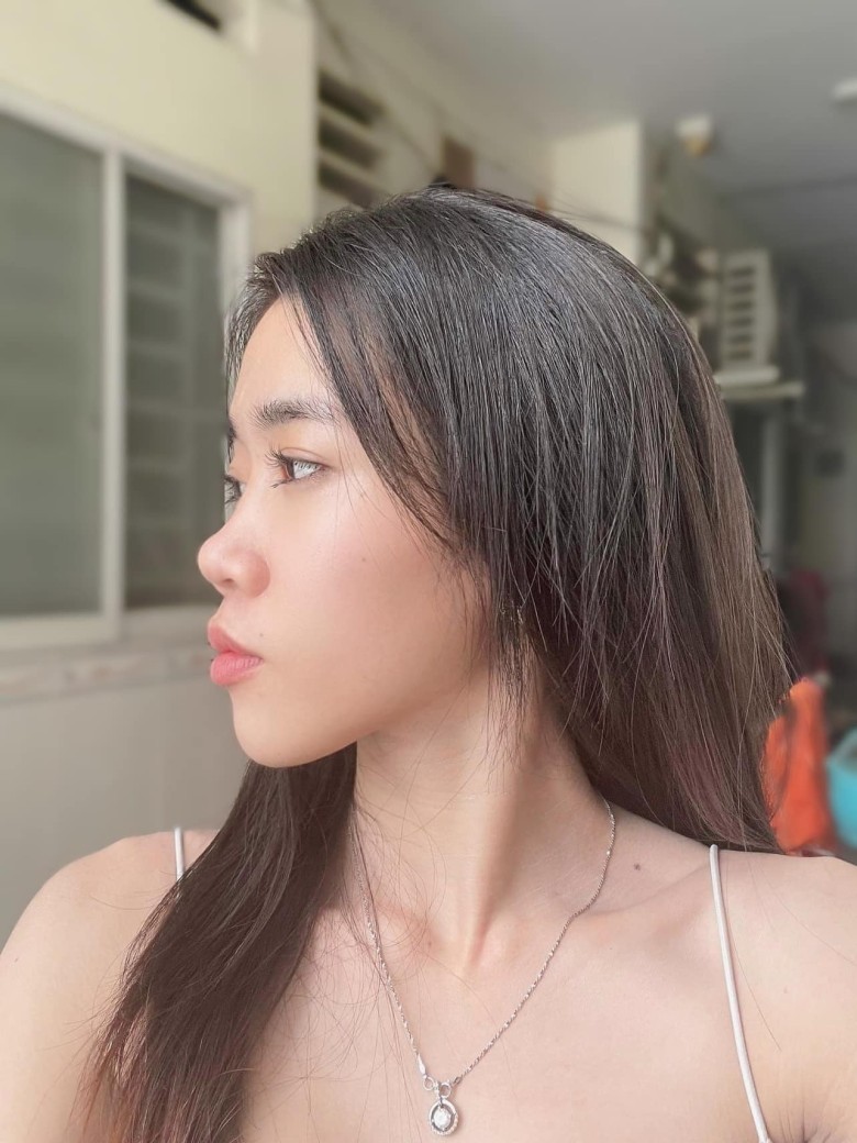 Khi nào nên sửa mũi hỏng?