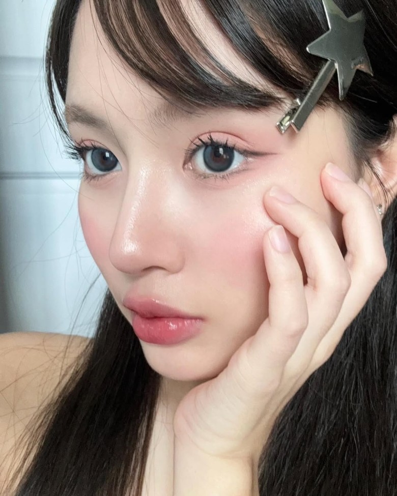 Biểu hiện dị ứng sụn là gì?