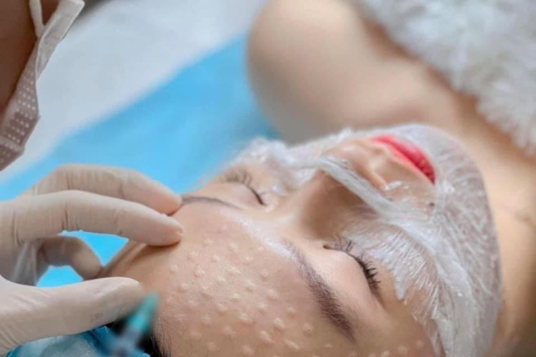 Tiêm Meso tác động chủ yếu lên lớp da nào để cải thiện độ đàn hồi?
