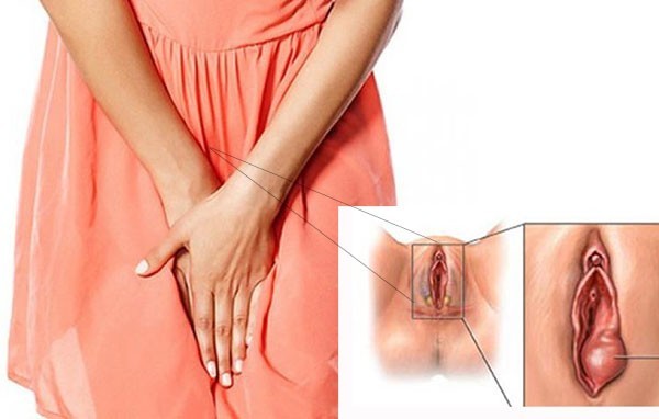 Bạn có tự tin với vùng kín hiện tại của mình không?