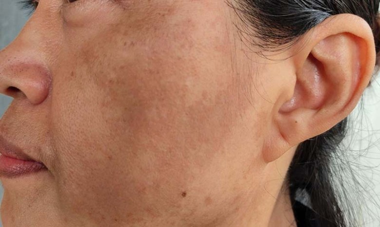 Ưu điểm của việc kết hợp Đông y và công nghệ là gì?