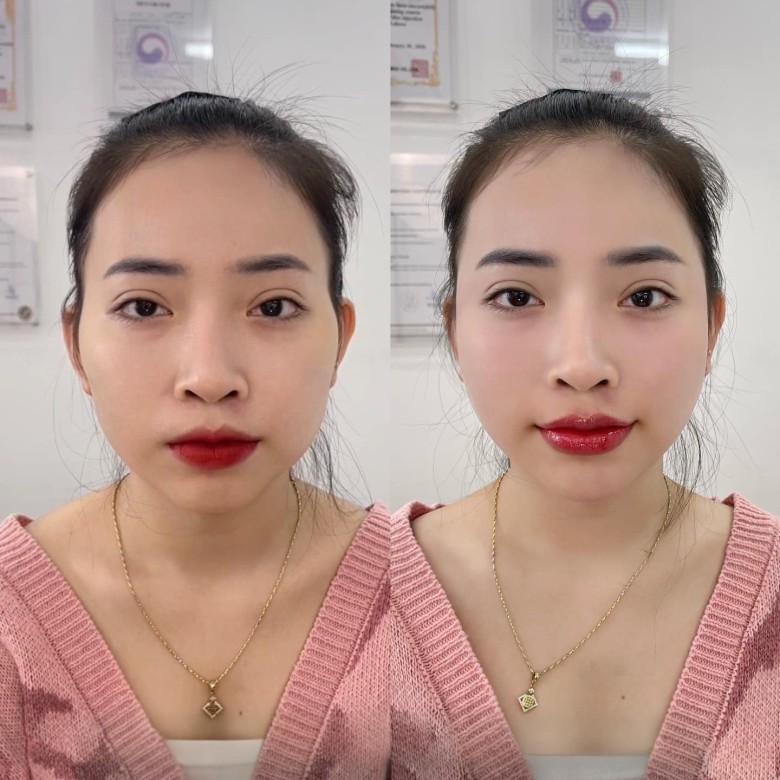 TỔNG QUAN DỰ ÁN