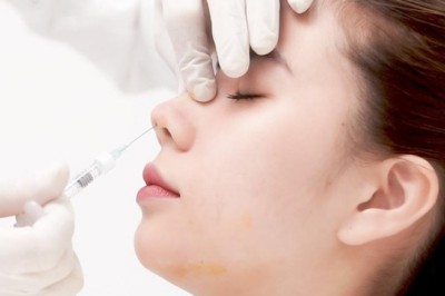 Phương pháp nâng mũi không xâm lấn – Lựa chọn an toàn