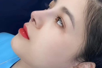 Sau nâng mũi nên kiêng gì để mũi ổn định?