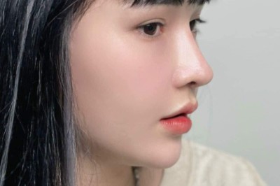 Ai nên nâng mũi cấu trúc?