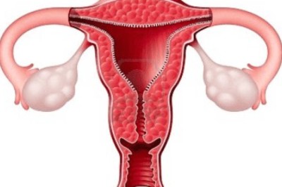 Bệnh viêm âm đạo – nỗi ám ảnh thầm kín của nhiều chị em