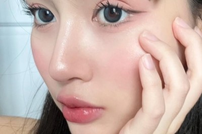 Dị ứng sụn – Biểu hiện và phòng tránh