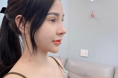 Khi nào tháo nẹp sau nâng mũi