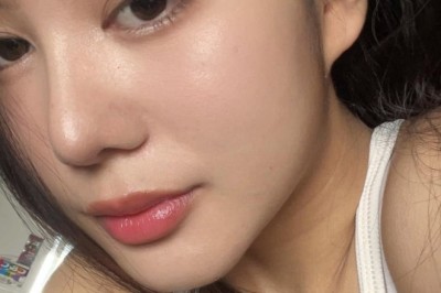 Nâng mũi cấu trúc – Khi nào nên chọn?