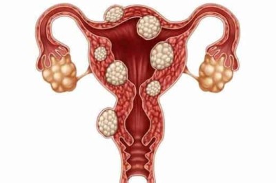 Rối loạn kinh nguyệt – không chỉ là chuyện sinh lý
