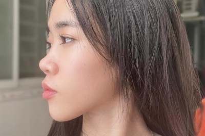 Sửa mũi hỏng – Khi nào nên thực hiện