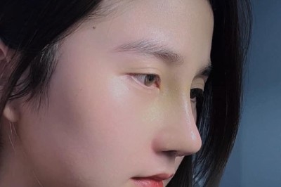 Sụn tai – Ưu điểm khi nâng mũi