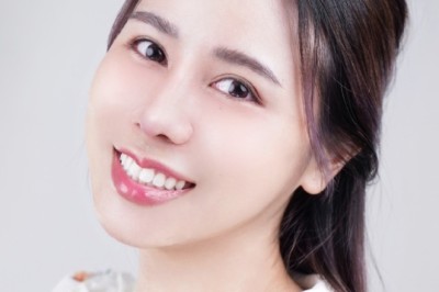 Thói quen cần tránh sau nâng mũi