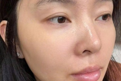 Trị Mụn Nội Tiết – Điều Hòa Hormone, Da Sạch Mịn | Thegioikhoedep.com